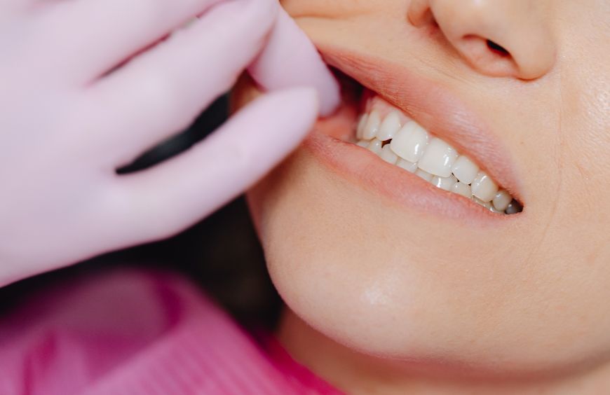 Quel est l'intérêt du CBD contre les douleurs dentaires ? 
